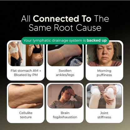 Lymphatic Drainage Capsules